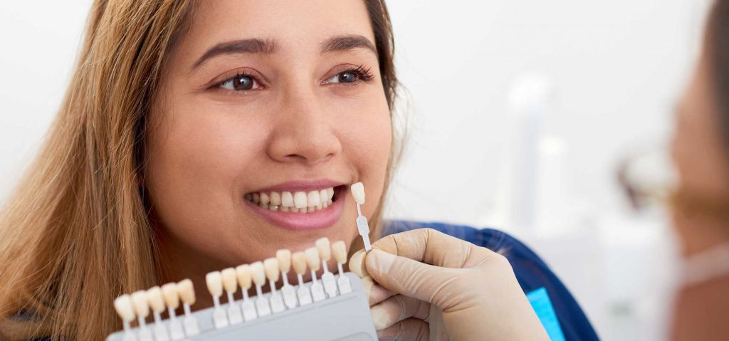 woman with veneers