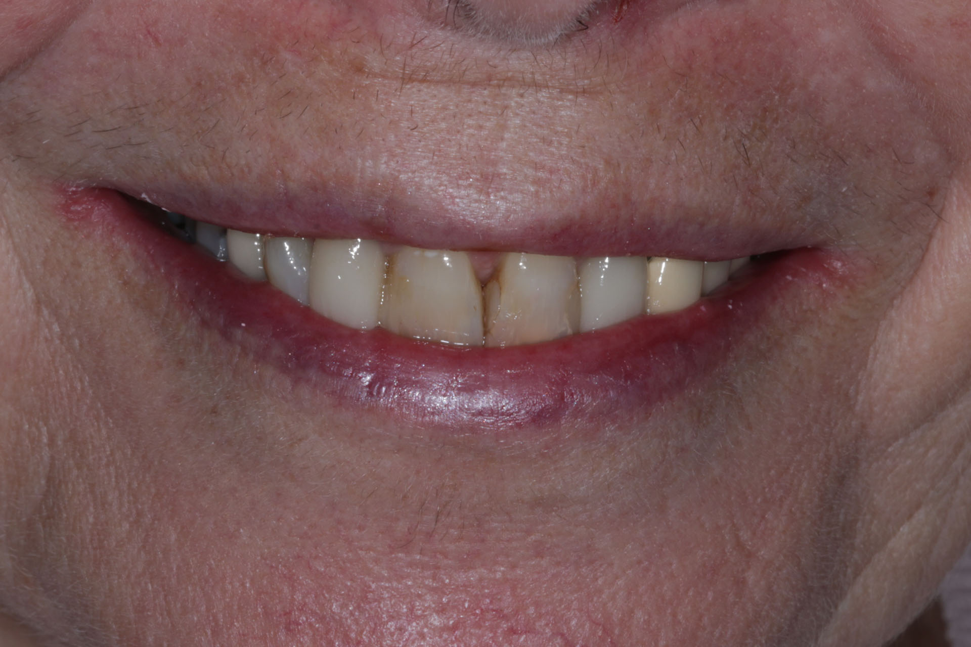 Before image
