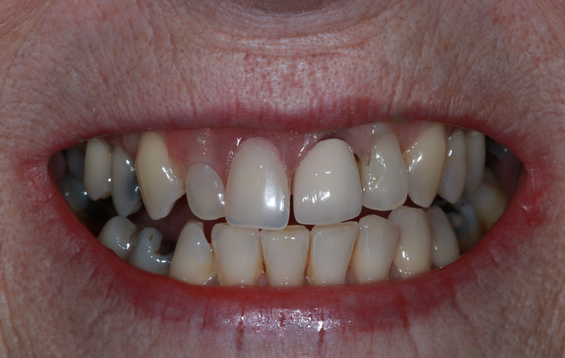 Before image